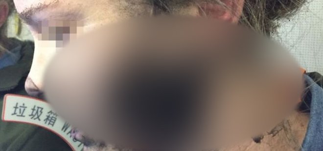 UÇAKTA KULAKLIK ALEV ALINCA BAKIN NELER OLDU!
