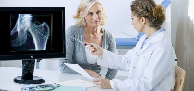 OSTEOPOROZ, KADINLARI TEHDİT EDİYOR!