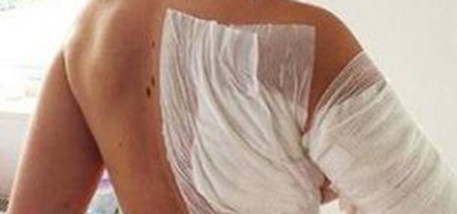 ASİTLİ SALDIRIDA ÜNLÜ MODEL DE YARALANDI!