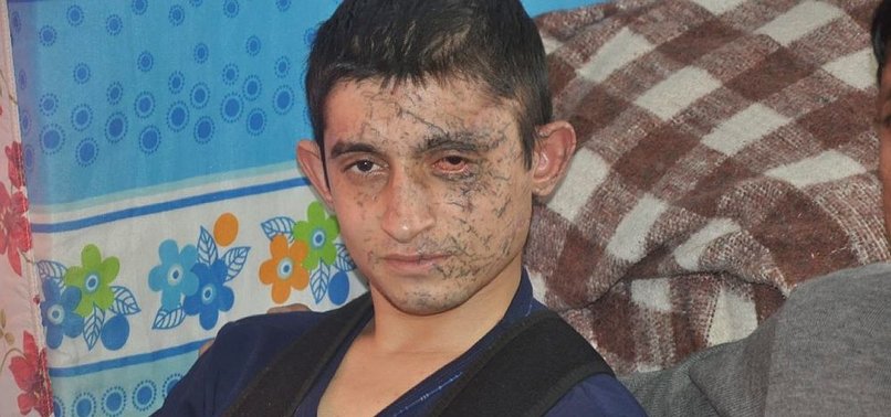 14 ASKERİMİZİN ŞEHİT OLDUĞU ANLARI ANLATTI