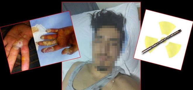 NÜKLEER ‘TESBİH’ DEHŞETİ! MAHALLE BİLE KARANTİNAYA ALINDI!